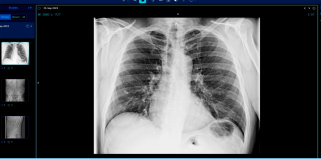 VisualizadorDICOM
